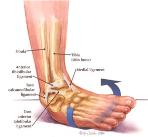 bolovi u zglobovima u stopalima
