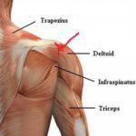 bol mišića u ramenu joint
