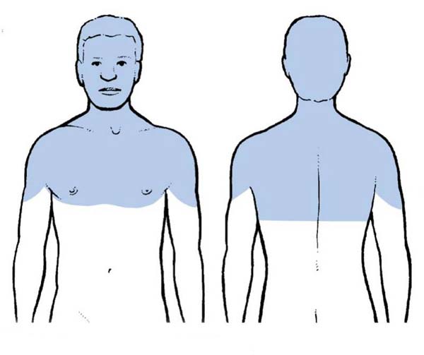 kako se riješiti boli u vratnim zglobovima